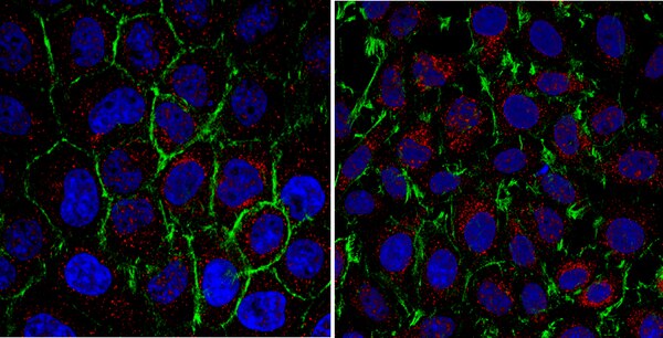 Anti-PSAT1 Antibody | ABC950